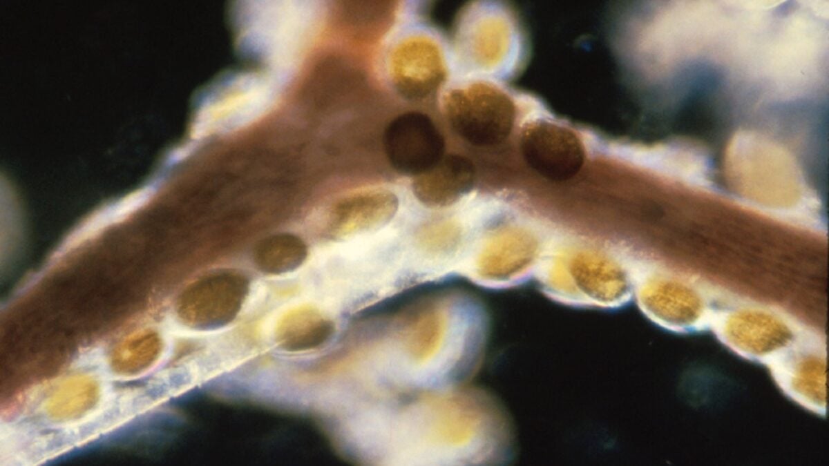 Mořské toxiny: Skryté nebezpečí v našich pokrmech, které přežívá vaření a vyvolává epidemie